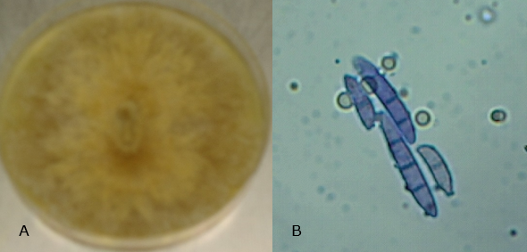 A: Fusarium graminearum
con micelio lanudo algodonoso, colonia de color crema; B: Macroconidia:
curva típica septada, célula basal en forma de pie y célula apical cónica.
Lente de inmersión 100x.