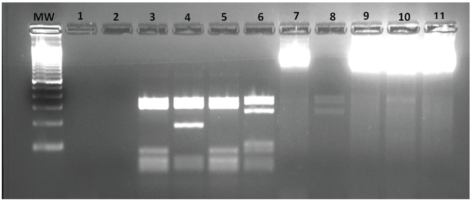  PCR-RFLP. Obtención de patrones de amplificación posterior a la
digestión con la enzima HaII. MW. Marcador 100 pb, Pozo 1 control negativo,
pozo 2. Control negativo, pozo 3. L. (V.) panamensis, pozo 4. L.
braziliensis (V.), pozo 5. L. (V.) guyanensis, pozo 6. L. (L.) infantum, pozo
8. L. (L.) mexicana. Pozo 7, 9-11 Controles sin digerir