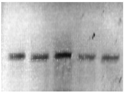 Electroforesis horizontal en gel de agarosa (1.5%) de los microsatélites LCA
19, LCA 05 y YWLL 08, obtenidos luego de la amplificación por PCR (aprox. 200
pb)