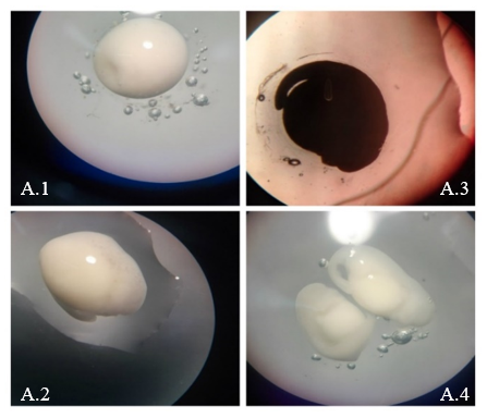 Día 2: Desarrollo
de los embriones hasta la aparición de la cola. A.1: Observación de la membrana
vitelina y pliegues neurales. A.2: Etapa de brote de la cola. A.3: Embrión en
etapa de repuesta muscular. A.4:  Vista dorsal del embrión, comienzo del desarrollo
y diferenciación de la cola.

 