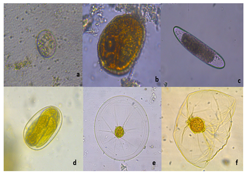 huevo de estrongiloide