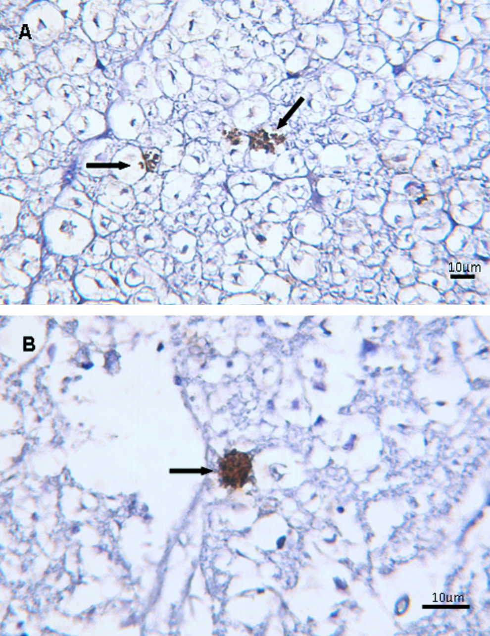 Figura 1: Fotomicrografías que muestran el resultado positivo de la inmunohistoquímica (LSAB, Dako Cytomation) para S. neurona en muestras de médula espinal (A) y cerebro (B). Se marcan específicamente (color pardo) merozoitos y merontes de S. neurona (flechas).    