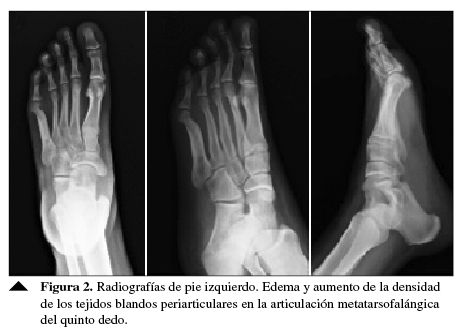 Radiografías de pie izquierdo