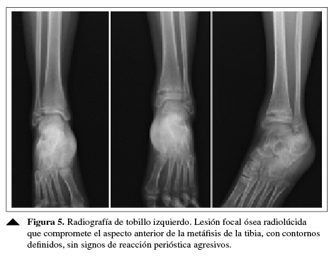 Radiografía de tobillo izquierdo