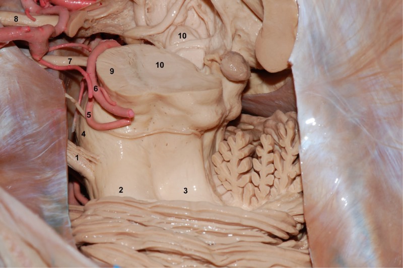 Superolateral
view of the brainstem and cerebellum.