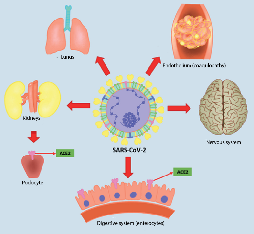  Primary infection and evolution of
COVID-19. The figure shows multiple organs that can be affected by SARS-CoV-2,
due to the presence of angiotensin-converting enzyme 2 (ACE2) receptors in
different organs, including lungs, kidneys, neurons and enterocytes, among
others.