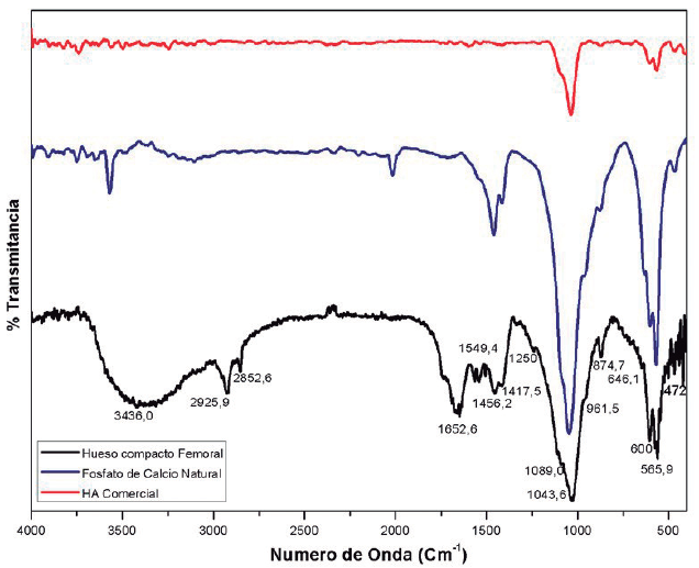 Análisis
espectral de las tres muestras analizadas. Negro: Hueso compacto, Azul:
Apatita, Rojo: Hidroxiapatita comercial, Técnica FTIR.