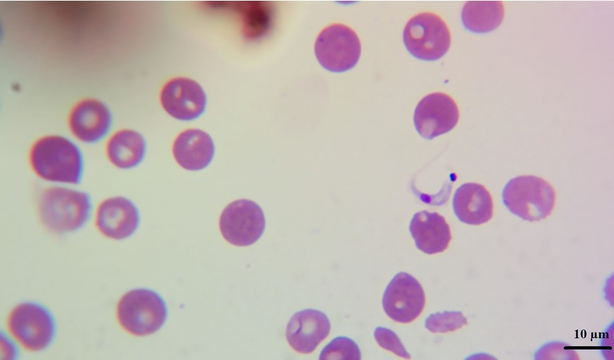 Trypomastigote of Trypanosoma cruzi in peripheral blood smear from a
  dog of Nicaragua.    