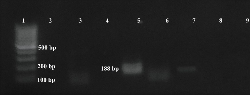  PCR
  products, line 3 (negative control) line 5 (positive sample), line 7 (positive control).
  The product of 188 bp corresponds to Trypanosoma cruzi