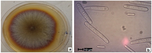  a) Colony of D. novozelandica growing in PDA with 20 days of
incubation. b) Conidia (40×)