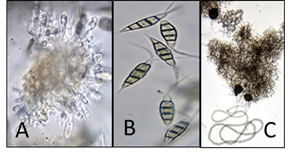 Reproductive structures observed. Diplodia sp. sporodochium (A);
conidia of Pestalotiopsis
sp. (B); pycnidium and tendrils of Phomopsis
sp. (C)