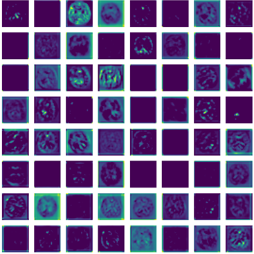 Filtros
convolucionales aplicados a una imagen para resaltar los bordes horizontales