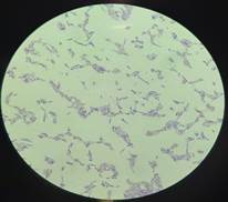  Gram +, bacilos, muestra de jardín vistos bajo el
  microscopio en el objetivo de 100x.
