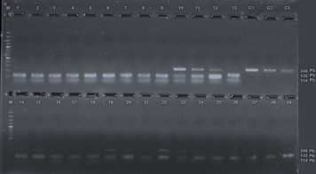 Figura 1. Gel de agarosa al 2% donde se observa los productos de PCR, Genotipo homocigoto TT (249 bp),  Genotipo homocigoto CC (135 y 114 bp), M: Marcador molecular 100 pb, números de pacientes positivos a H. pylori y controles (C), n=245