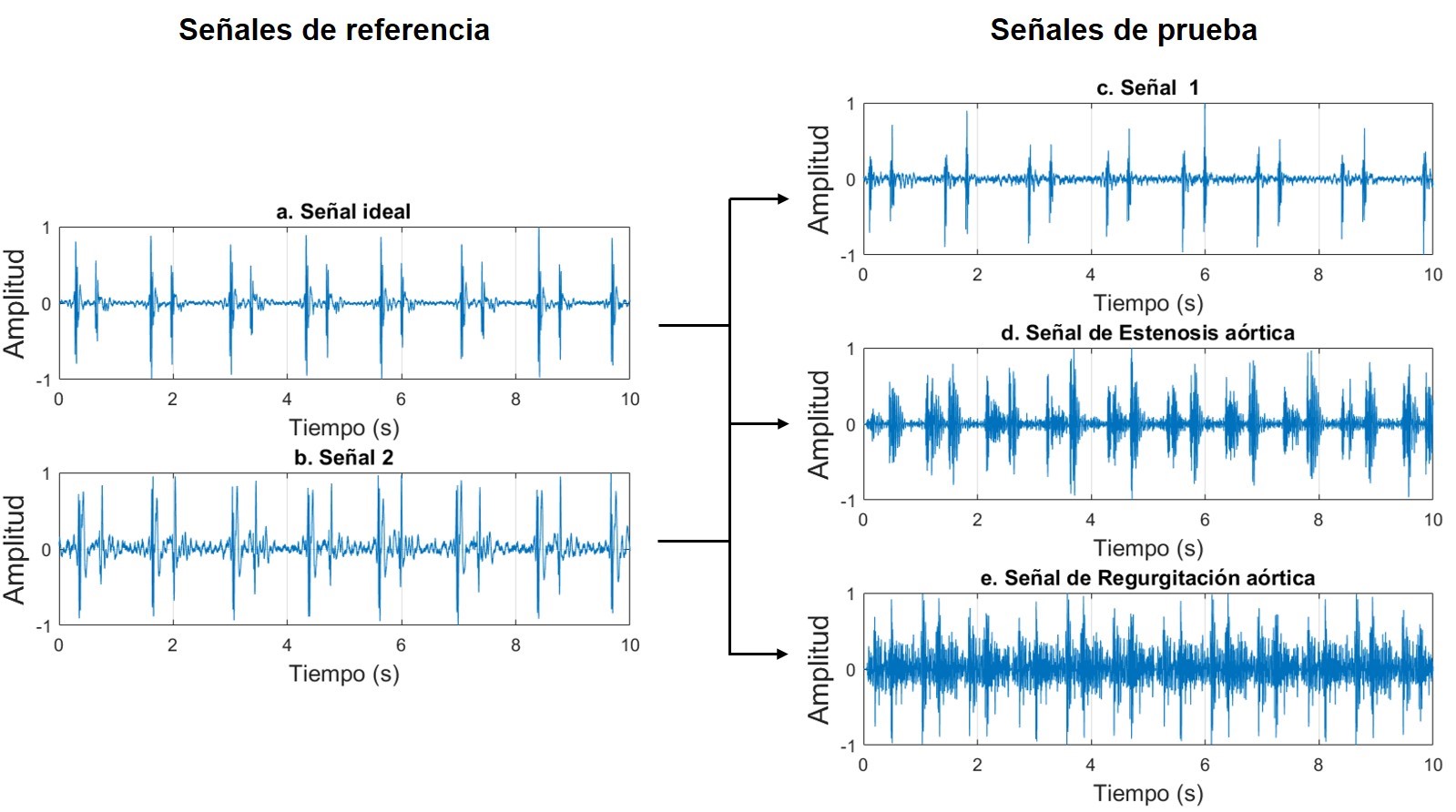 Diagrama de comparaciones entre señales.