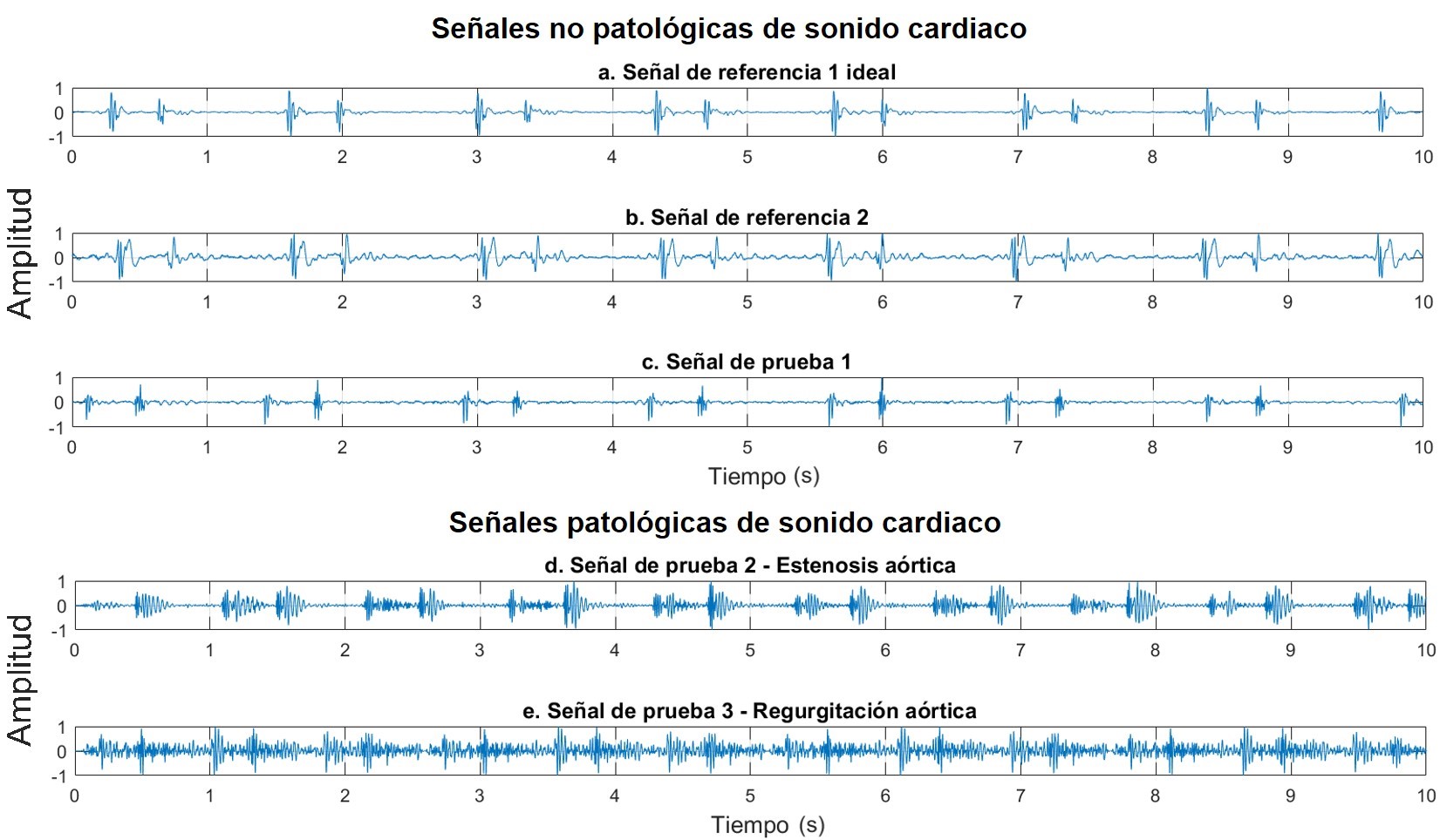Señales de sonido cardiaco empleadas en el desarrollo de la metodología.