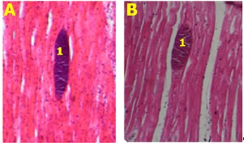 Morfología
típica de microquistes de  Sarcocystis lamacanis en sección longitudinal y 

 transversal en músculo cardiaco de camélido.
Tinción con hematoxilina y eosina. Aumento 10X