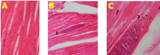 Estado degenerativo de músculo cardiaco de camélido. Tinción
con hematoxilina y eosina.  

Aumento 10X