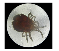 Dermanyssus gallinae, partes anatómicas: 3
pares de patas, Órgano tarsal