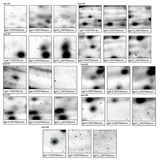 Comparación de
las manchas (proteínas) sugeridas como posibles diferencias entre las distintas
condiciones experimentales.