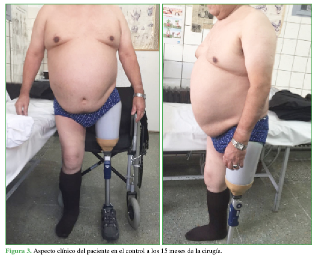 Aspecto clínico del paciente en el control a los 15 meses de la cirugía. 