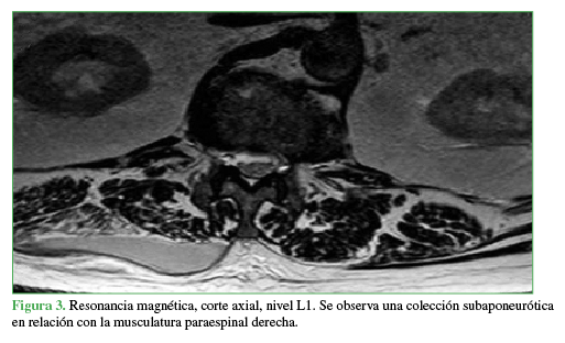 Figura 3. Resonancia magnética, corte axial.