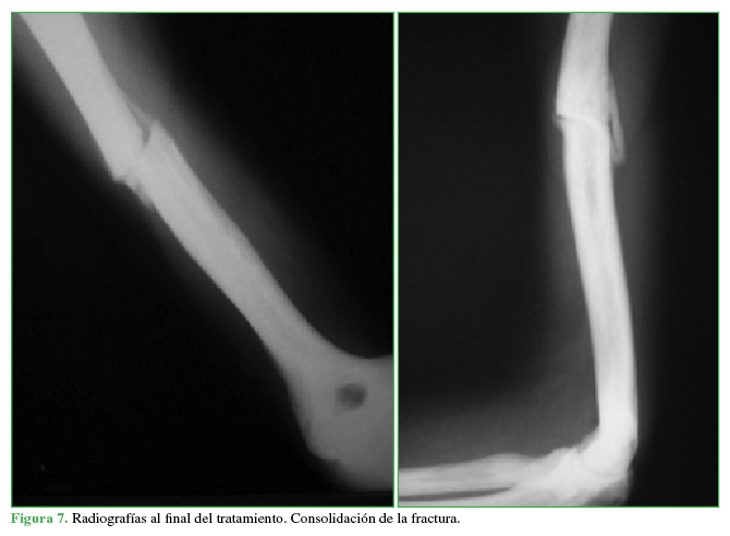 Radiografías al final del tratamiento
