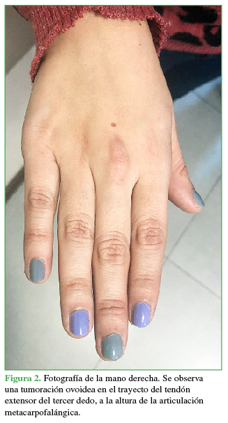 Fotografía de la mano derecha.