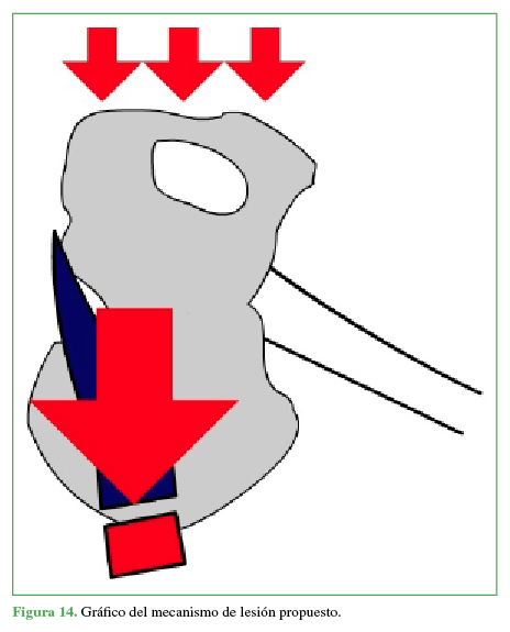 Gr&aacute;fico del mecanismo de lesi&oacute;n propuesto