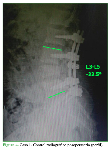 Control radiogr&aacute;fico postoperatorio (perfil)