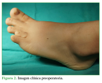 Imagen clínica preoperatoria