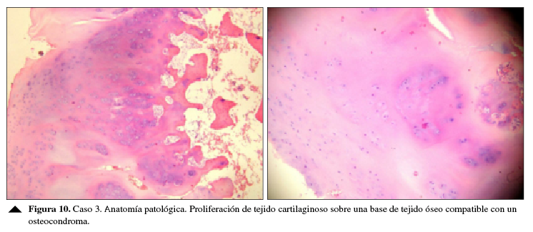 Caso 3. Anatomía patológica