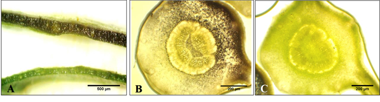Figura 1. Comparaci&oacute;n de tinci&oacute;n y coloraci&oacute;n de cortes de hojas
sanas e infectadas por HLB en c&iacute;tricos A. Parte superior: corte de hoja
infectada (positivo) por HLB, parte inferior: corte de hoja sana (negativo) sin
HLB. B. Peciolo de hoja infectada (positivo) por HLB. C. Peciolo
de hoja sana (negativo) sin HLB. FCA-UNA. San Lorenzo, Paraguay. 2017