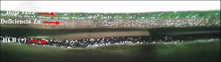 Figura 2. Tinci&oacute;n
de cortes de hoja. Corte superior de la hoja sana, corte medio de la hoja con deficiencia
de Zn y corte inferior de hoja positiva HLB. FCA-UNA. San Lorenzo, Paraguay.
2017.