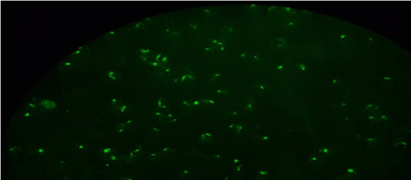 Patrón de fluorescencia de núcleo
otorgan a los epimastigotes de T. cruzi empleados como antígeno figurado, una
intensidad de fluorescencia marcada que se aprecian como pequeñas bombillas con
iluminación de color verde fluorescente central e irradiación hacia la
periferia.  El patrón de fluorescencia nuclear corresponde a muestras de
personas identificadas como infección por Leishmania spp (panel A). 