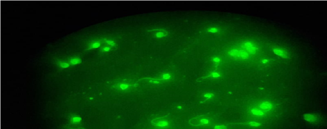 Patrón de fluorescencia de núcleo y
membrana otorgan a los epimastigotes de T. cruzi empleados  como
antígeno figurado, una intensidad de fluorescencia marcada que se aprecian como
pequeñas bombillas con iluminación de color verde fluorescente.  El patrón
de fluorescencia núcleo/membrana corresponde a muestras de personas identificadas
como coinfección por Leishmania spp y Trypanosoma cruzi.  (Panel
B).  