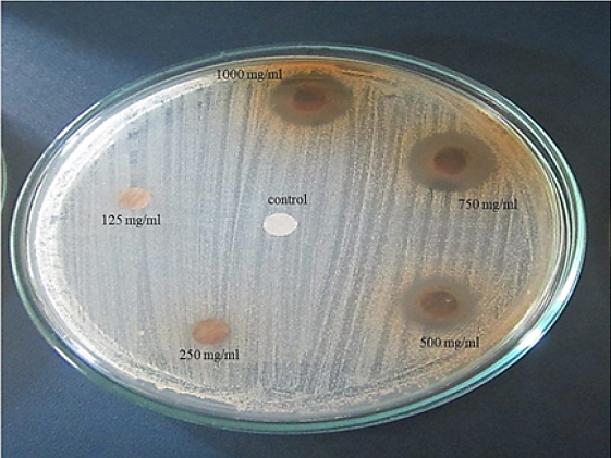 Halos inhibitorios de S. aureus ocasionados
por el extracto etan&oacute;lico de A. muricata