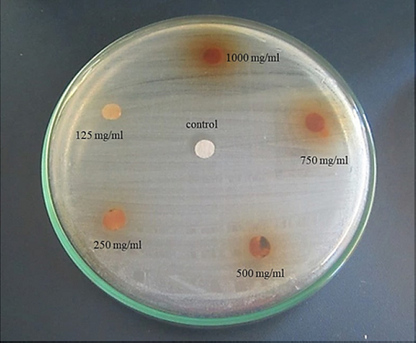 Halos inhibitorios E. coli
ocasionados por el extracto etan&oacute;lico de A. muricata