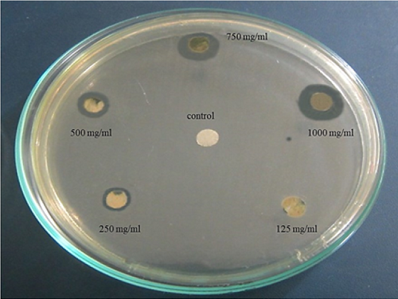 Halos inhibitorios St. B-hemol&iacute;ticos
ocasionados por el extracto etan&oacute;lico de A. muricata
