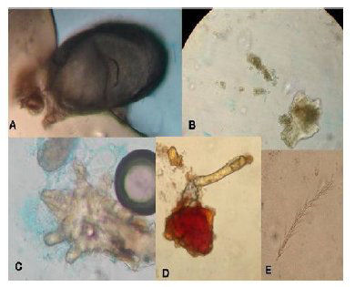 Impurezas
observadas en el prop&oacute;leos en bruto: A y C. &Aacute;caros. B. Ceras. D. Resina y
fibras. E. Pelos y partes de insectos