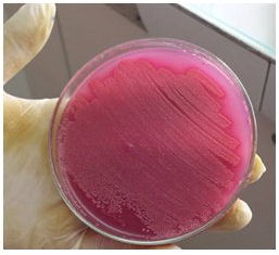 Escherichia coli cultivada en agar  

MacConkey