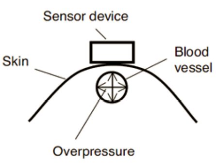 Fig. 11