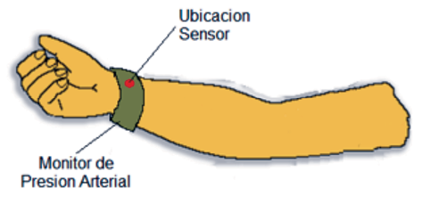 Fig. 13