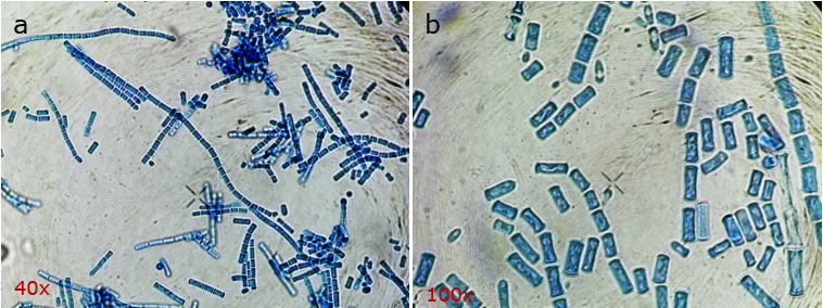 Estructuras f&uacute;ngicas: artroconidios unicelulares en cadena de Geotrichum sp., observados en 40x (a) y en 100x (b)