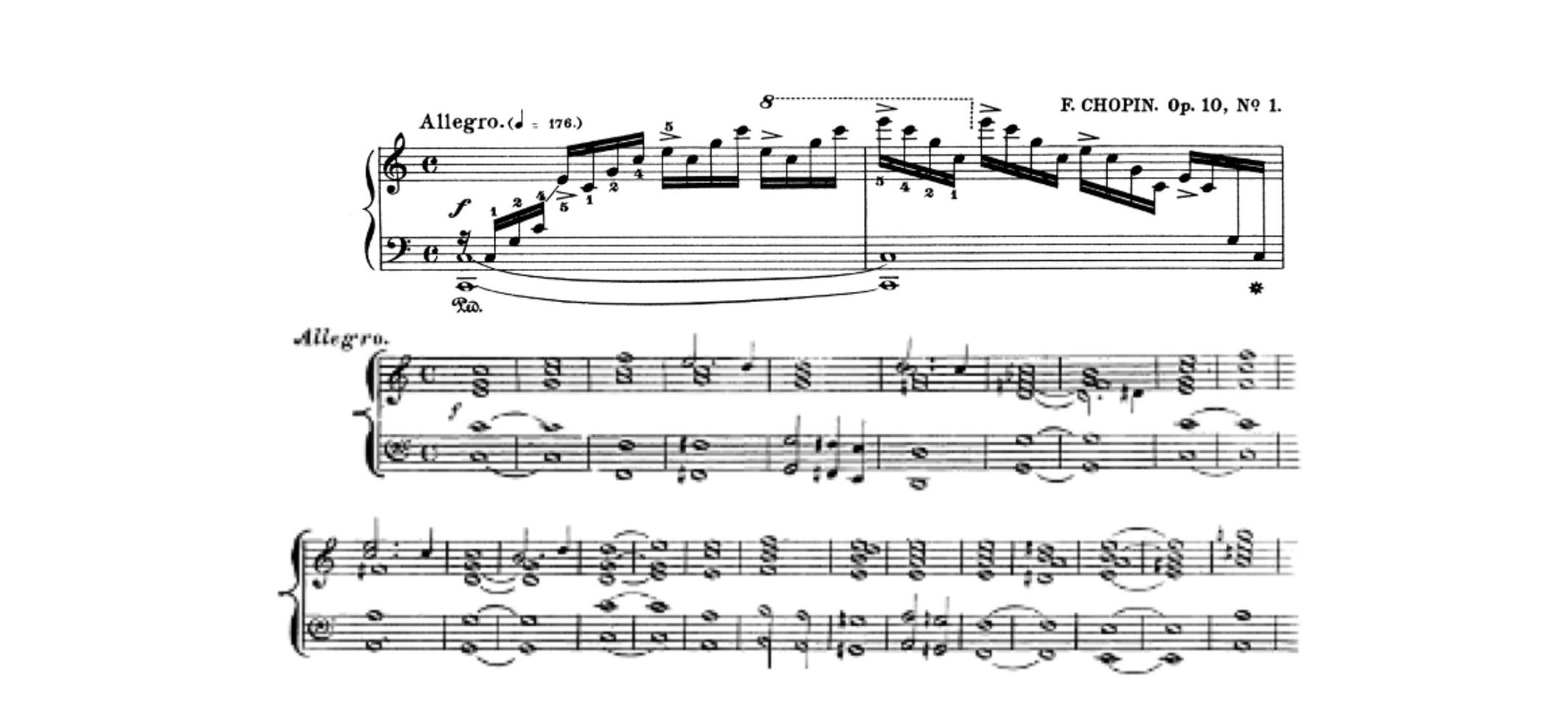 Fig. 13 – Contínuo imaginário na redução rítmicas apresentadas por Czerny (1848, p. 92-93 apud AGAWU, 1989, p. 287), sobre o Estudo op. 10, n. 1, de Chopin.
