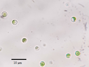 Parachlorella kessleri (1.000x)