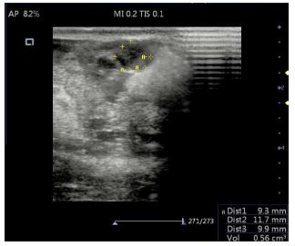 Evaluación ultrasonográfica de las  

características
morfométricas y ecotextura del CL de llamas receptoras en modo B