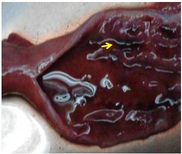 Small intestine. With hemorrhagic enteritis