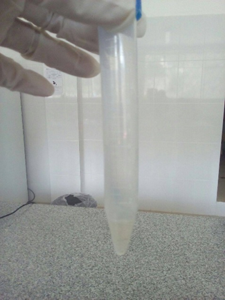 Collection of the ejaculate