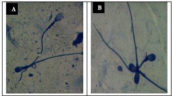 Integridad acrosomal con tinción Coomasie
blue. (A) EPZ con pérdida de acrosoma y (B) EPZ acrosoma intacto